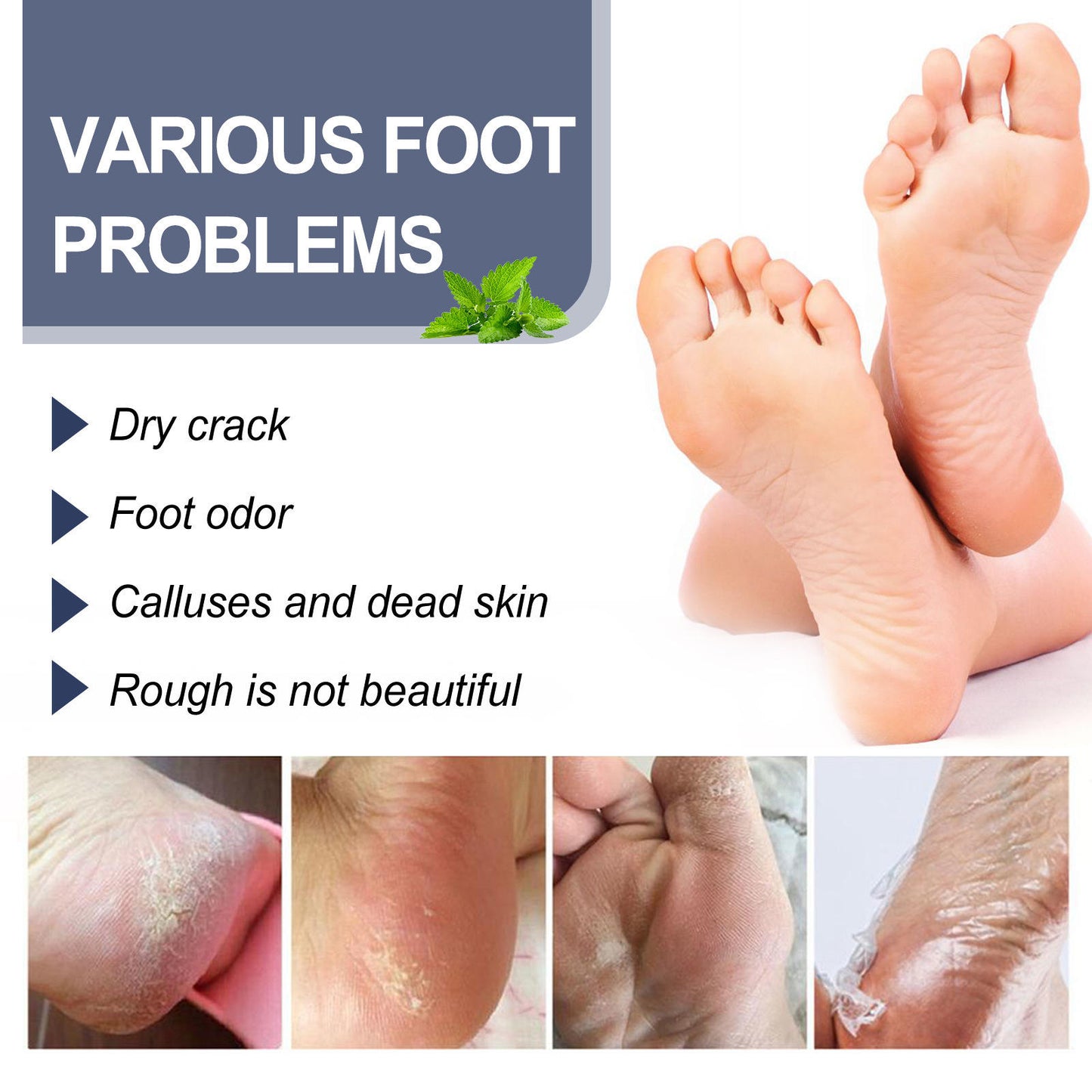 Anti Fungal Odor Removal Natural Foot Deodorant Spray PACK OF 2