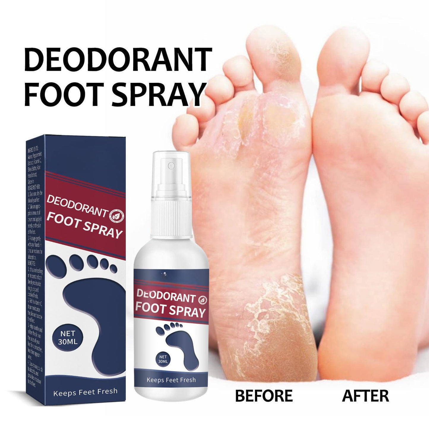 Anti Fungal Odor Removal Natural Foot Deodorant Spray PACK OF 2