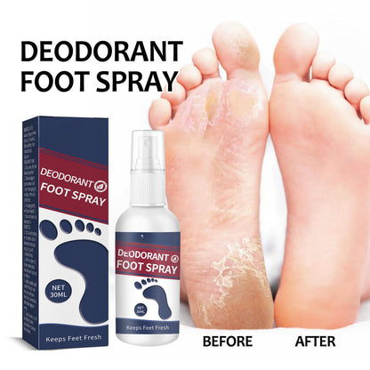 Anti Fungal Odor Removal Natural Foot Deodorant Spray PACK OF 2